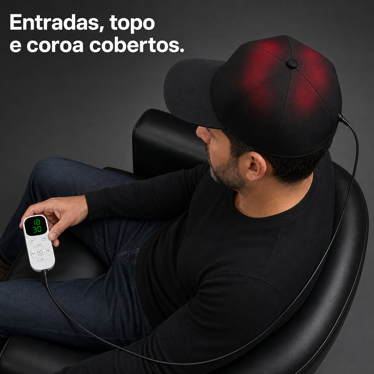 RevitaHair gallery 20260721 — cobertura de entradas topo e coroa