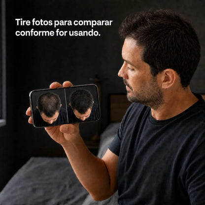 RevitaHair gallery 20260721 — acompanhamento por fotografias