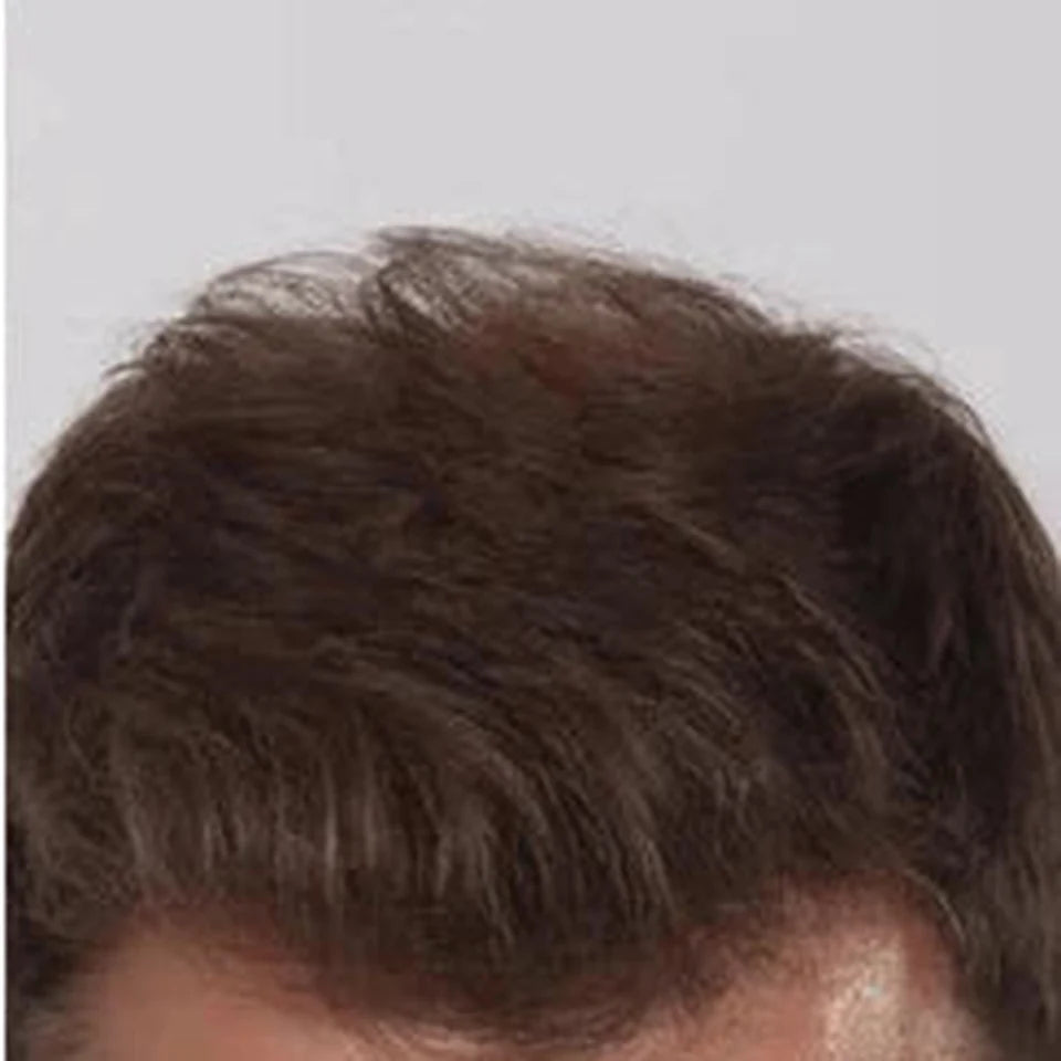 Foto real de referência após acompanhamento capilar em imagem de categoria